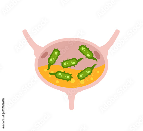 Virus in the bladder. Infection and inflammation of urine and internal organ. Medical problem and illustration. Green virus and bacteria.