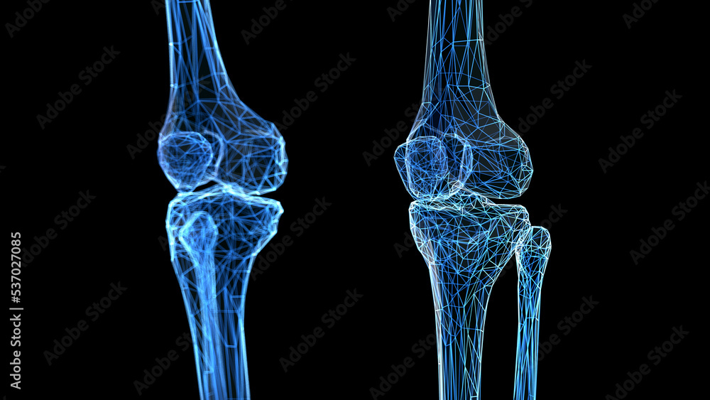 3d rendered medical illustration of a wireframe style skeletal knees 3d rendered medical illustration of a wireframe style skeletal knees