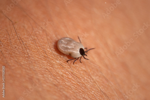Tick filled with blood sitting on human hand skin. Ixodes ricinus or scapularis. Close-up of dangerous parasitic mite in dynamic motion. Diseases transmission as encephalitis. Macro photography