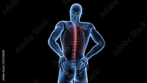 Wallpaper Mural 3d rendered medical animation of  a man having a painful back Torontodigital.ca