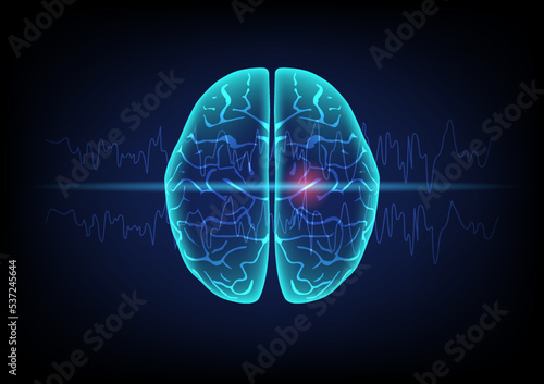 Illustration of human brain and brain waves on technology background. Concept of focal seizure.