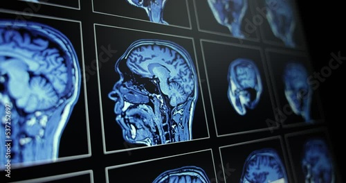 Several medical scans showing in motion