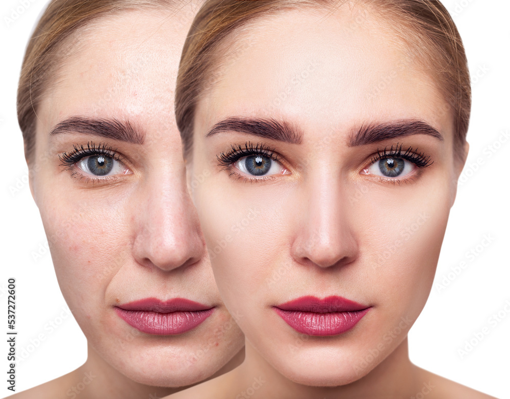Face of beautiful woman before and after skin retouch. Face of beautiful woman before and after skin retouch.