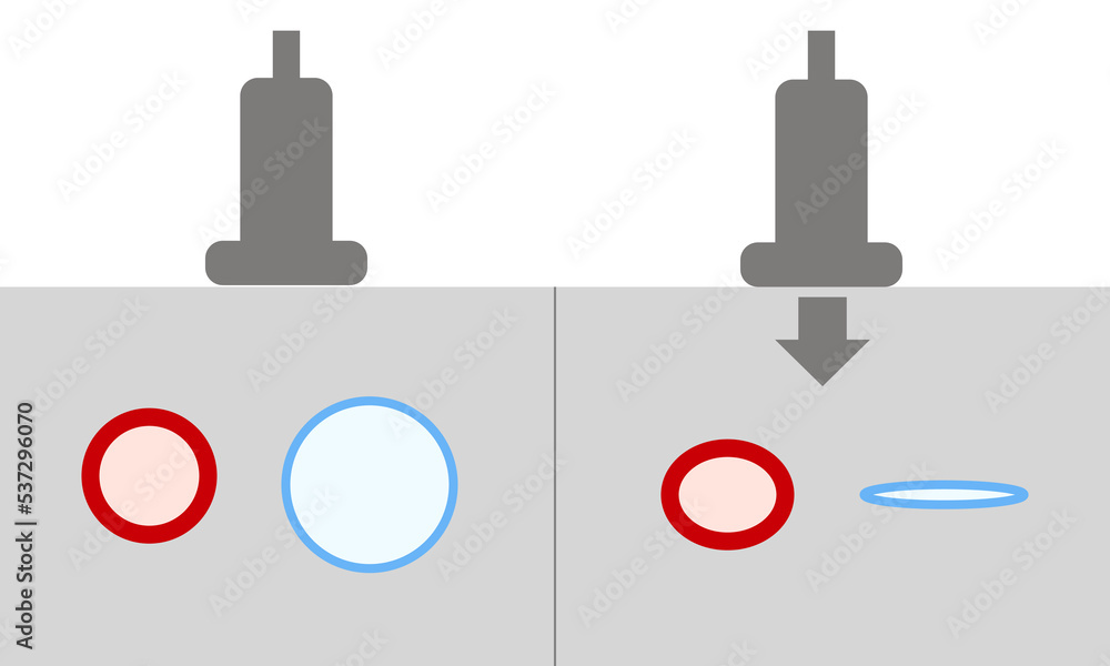 Diagram of Normal Compression Ultrasound For Diagnosis of Deep Vein ...