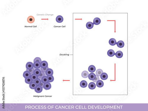 Illustration of process of cancer cell development