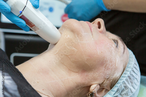Non-surgical face lifting. SMAS lifting ultrasonic. The process of rejuvenation. Hardware cosmetology. contour face plastic. Dermatologist doctor make a Caucasian woman an ultrasound facelift