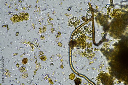 Microorganisms and biology in Compost and soil sample under the microscope  photo