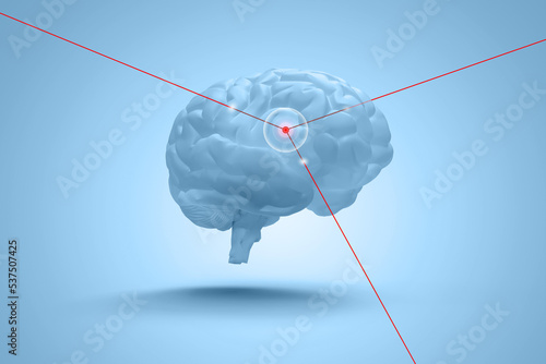 Soins du cerveau grâce aux lasers - illustration 3D photo