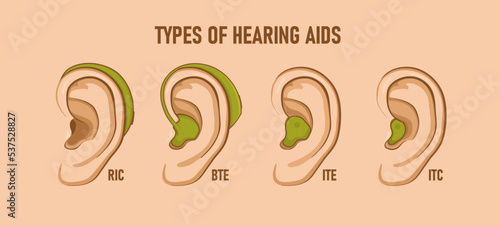 Types of hearing aids. Vector illustration