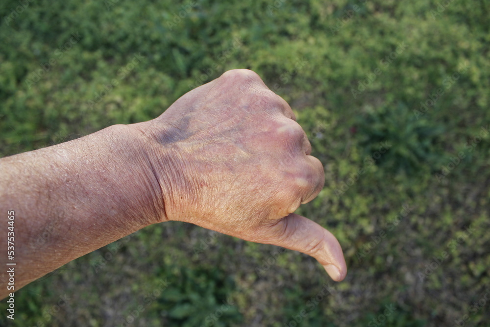 La mano del hombre con el pulgar hacia abajo tiene el significado de todo lo negativo, formando un diseño de postura de gesto original con un fondo de la hierba verde - obrazy, fototapety, plakaty 