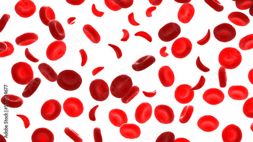 Fotografie 3d rendered medical illustration of sickle cells