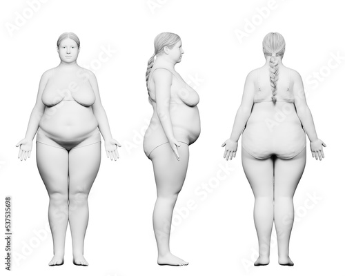 3d rendered medical illustration of an obese female body