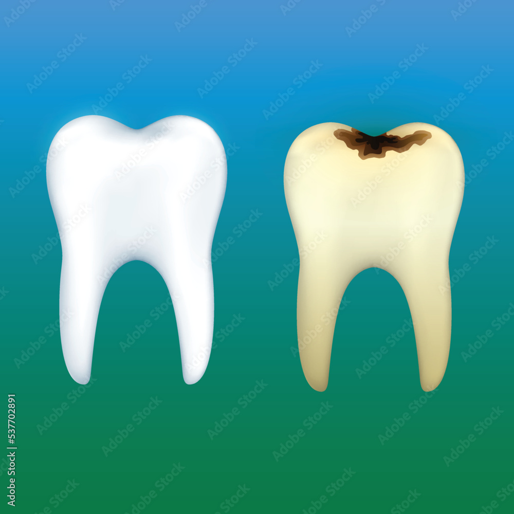 teeth dental care teeth dental care