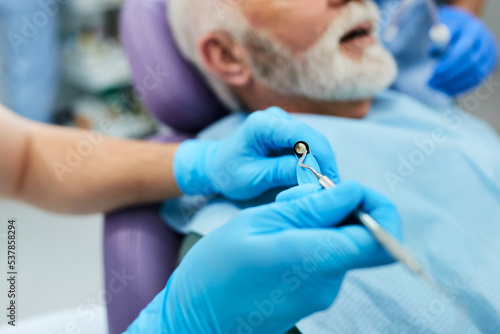 Close up of dentist preparing dental filling during patient's treatment at dentist's office.