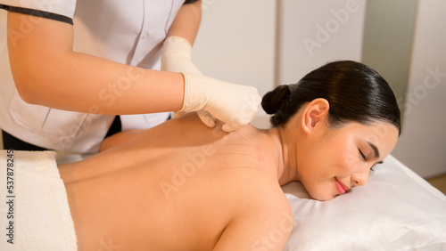 Beautiful Woman Received acupuncture treatment on back by therapist, chinese medicine treatment, health and healing concept.