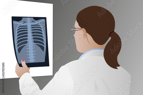 A female doctor examines a chest x-ray of a patient in the x-ray department of a hospital.
