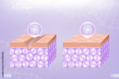 Hyaluronic acid before and after hair and skin solutions ad, purple collagen serum drop into skin cells with cosmetic advertising background ready to use, illustration vector.	
