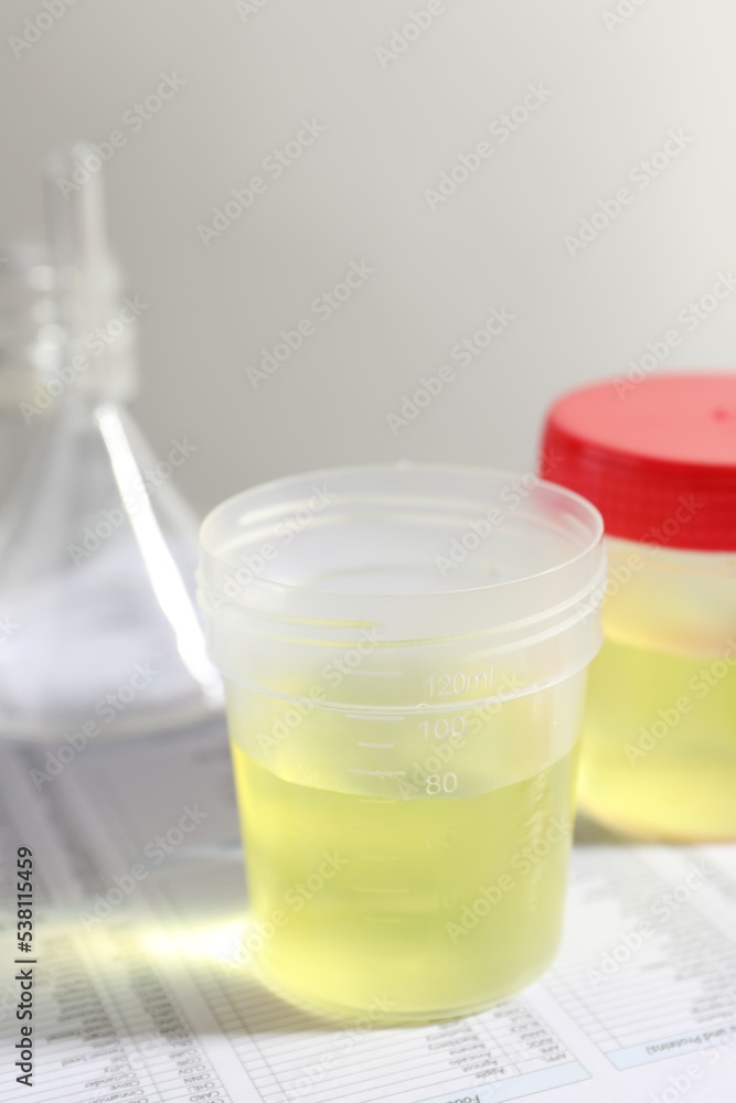 Containers with urine samples for analysis and glassware on test forms in laboratory Containers with urine samples for analysis and glassware on test forms in laboratory