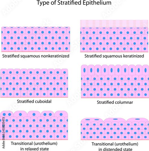 Type of Stratified Epithelium 