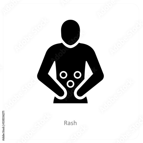 rash