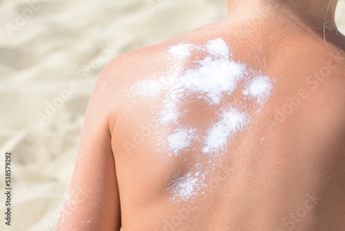 Child with sunscreen on back at beach, closeup
