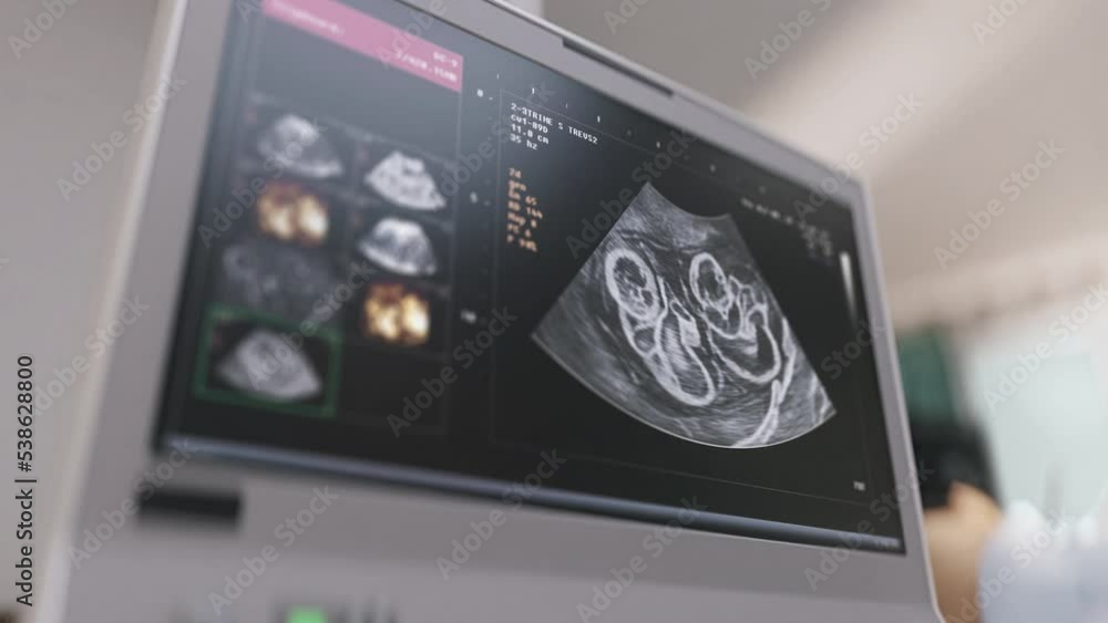 Scanner check the babies carried by a pregnant female. Medical scanner