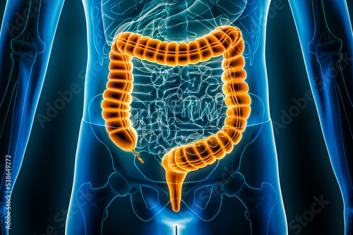 Large intestine or colon or bowels 3D rendering illustration close-up. Irritable bowel syndrome, anatomy, medical, biology, science, healthcare, pathology, inflammatory disease concepts.