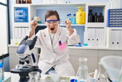 Hispanic girl with down syndrome working at scientist laboratory angry and mad raising fists frustrated and furious while shouting with anger. rage and aggressive concept.