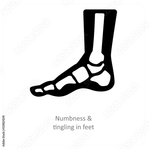 numbness & tingling in Feet