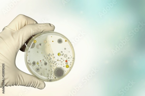 Hand hold a glass Petri dish with bacteria.