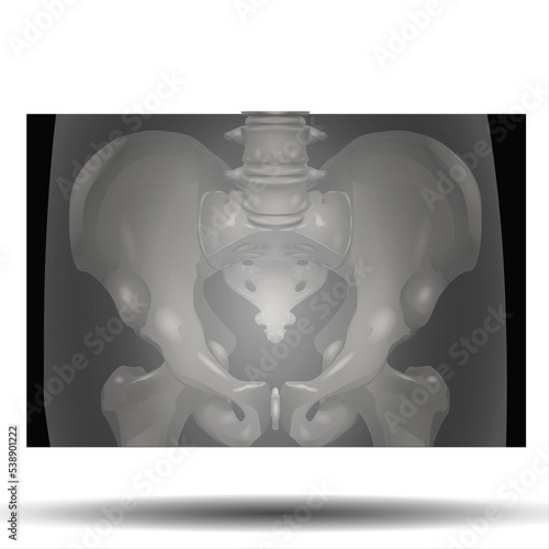 X-Ray of Pelvis - Fla source file available - Structure of the pelvis. Anatomical poster of human skeleton. Pelvic bones concept. Sacrum, Ischium, pubis and ilium. Coccyx and pubic symphysis in male. photo