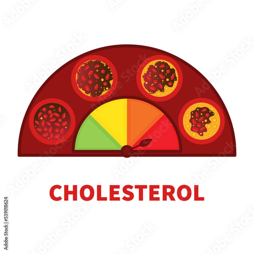 Cholesterol level on blocked blood vessel medical diagram. Atherosclerosis risk scale. Meter gauge of ldl and hdl lipoprotein. High and low fat test indicator. Healthcare concept. Vector illustration.