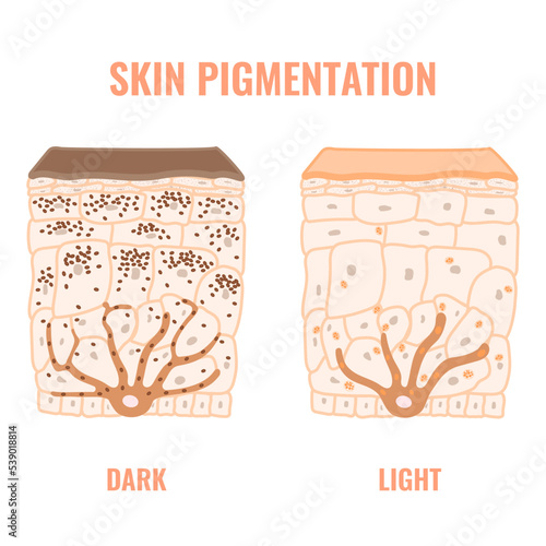Melanin content and distribution in different skin phototypes. Pigmentation mechanism in dark and light skin. Epidermis cross-section infographic medical diagram. Vector illustration. photo