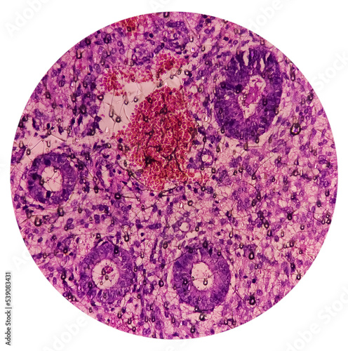 Endometrial tissue: Photomicrograph of endometrial tissue, proliferative phase in endometrium. Follicular phase. photo