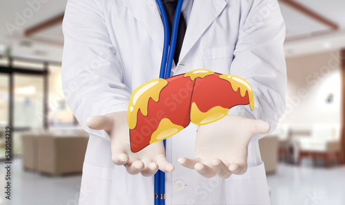 doctor touch fatty on liver , concept fatty liver photo