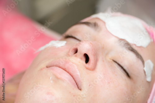 Girl's face during a cosmetic procedure. Cleansing the skin of the face from comedones.