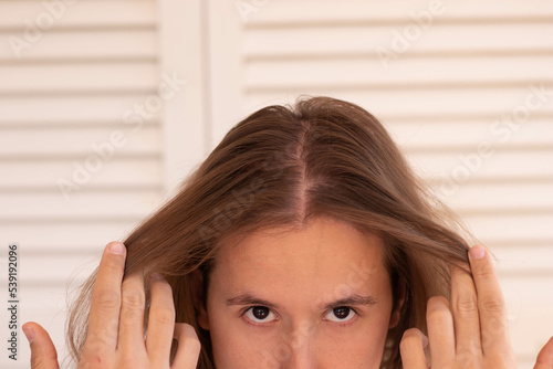 Close up view of young man with long hair showing his hair line with poor hair quantity for hair loss problems