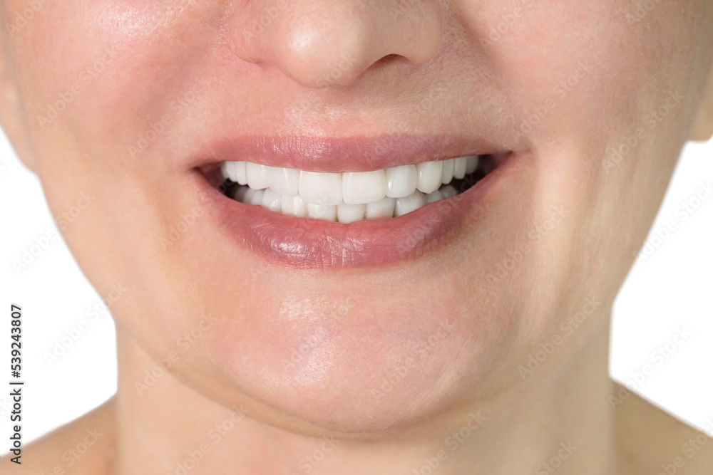 Obraz premium close up of beauty woman tooth, isolated on white background