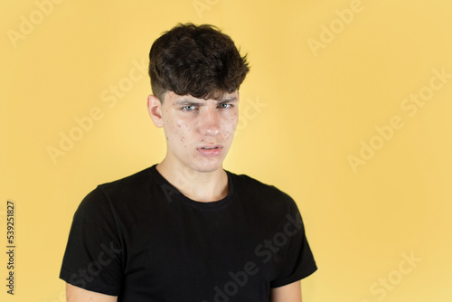 A teenage boy on a yellow background with pimples on his face is suffering from a headache, a teenage boy has skin problems