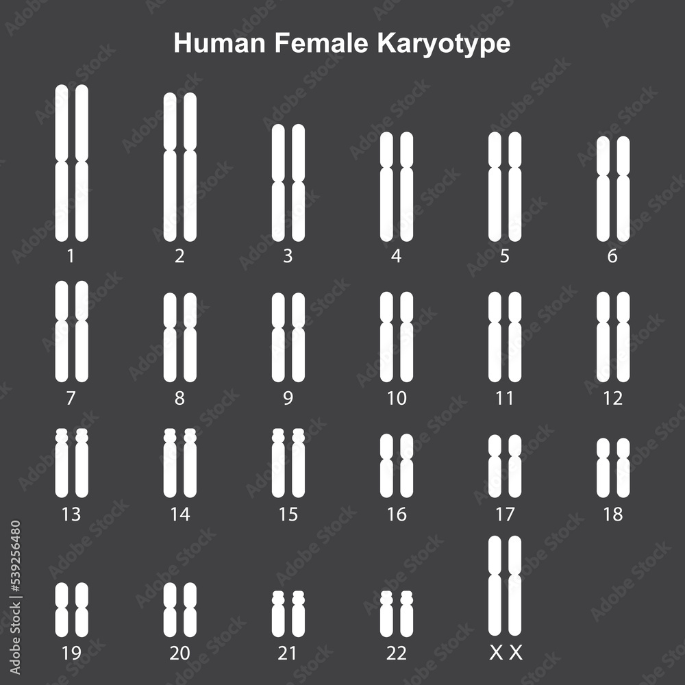 Scientific Designing of Female Normal Karyotype. Female Complete Set of