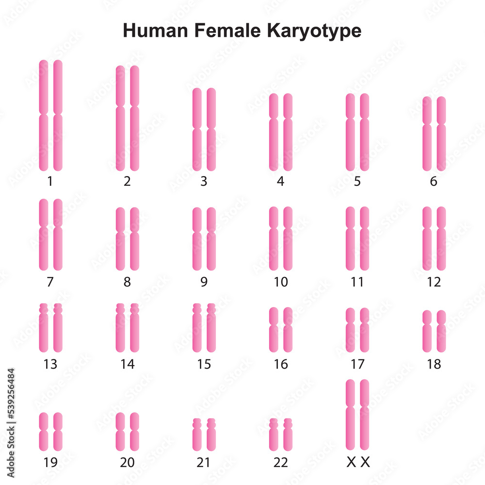 Scientific Designing of Female Normal Karyotype. Female Complete Set of