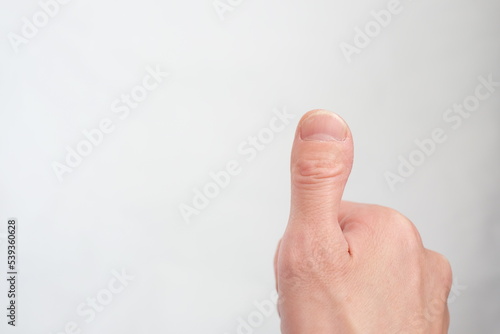 深爪した親指
