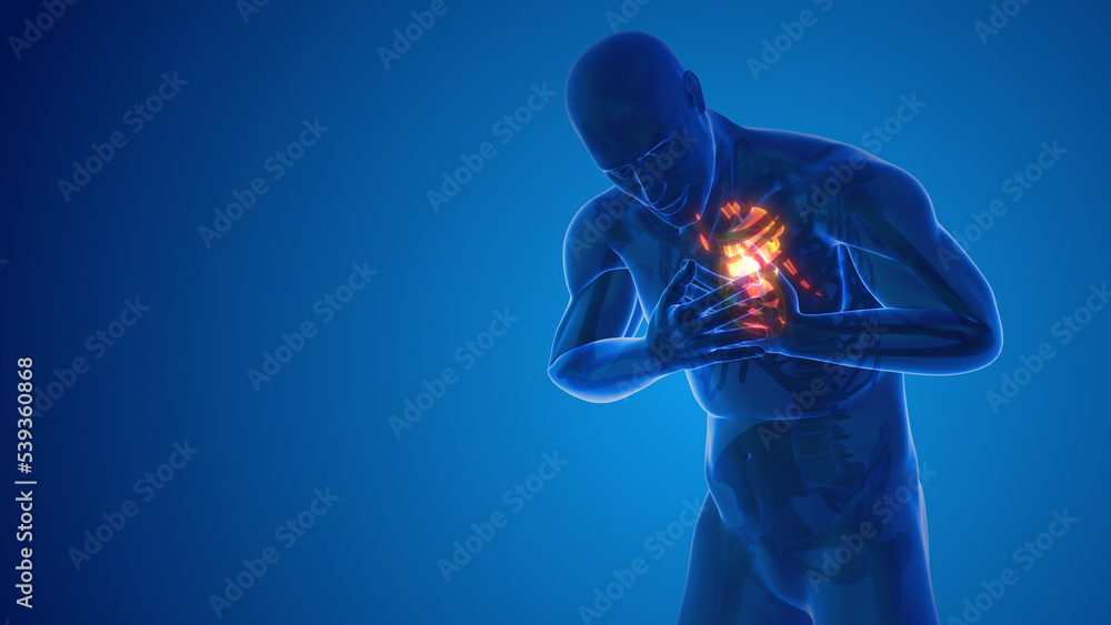 heart-attack-pain-in-chest-stock-illustration-adobe-stock