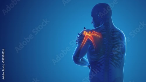 Pain in the shoulder joint photo
