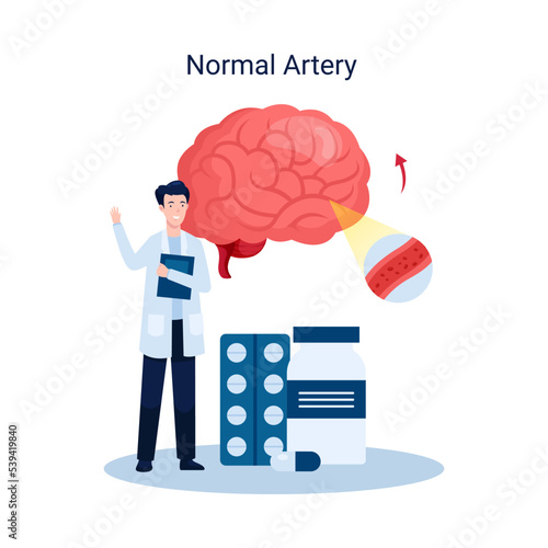 Ischemic stroke disease concept illustration, normal artery