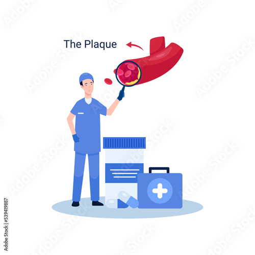 Thrombosis disease concept illustration, plaque affected