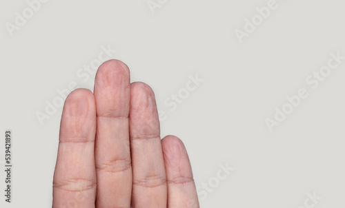 woman palms hands fingers isolated on light background.wrinkled pruney fingers from staying too long in water.young female palm wrinkles on fingers.body parts details.wide open hand fingers photo