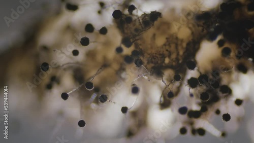 Aspergillus niger fungi mold dense cluster under microscope dark view photo