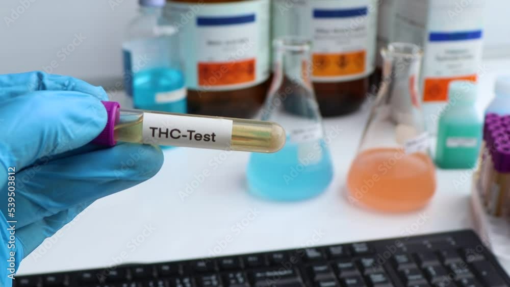 Urine samples for testing THC in the laboratory, urine sample in test