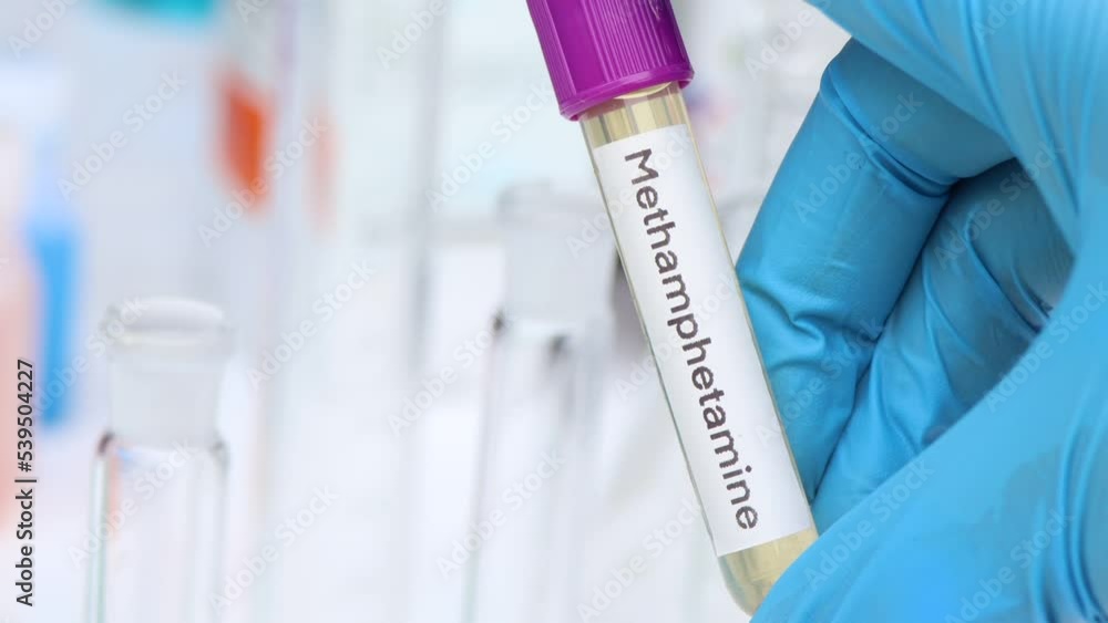 Urine samples for testing Methamphetamine in the laboratory, urine sample in test tube Urine samples for testing Methamphetamine in the laboratory, urine sample in test tube